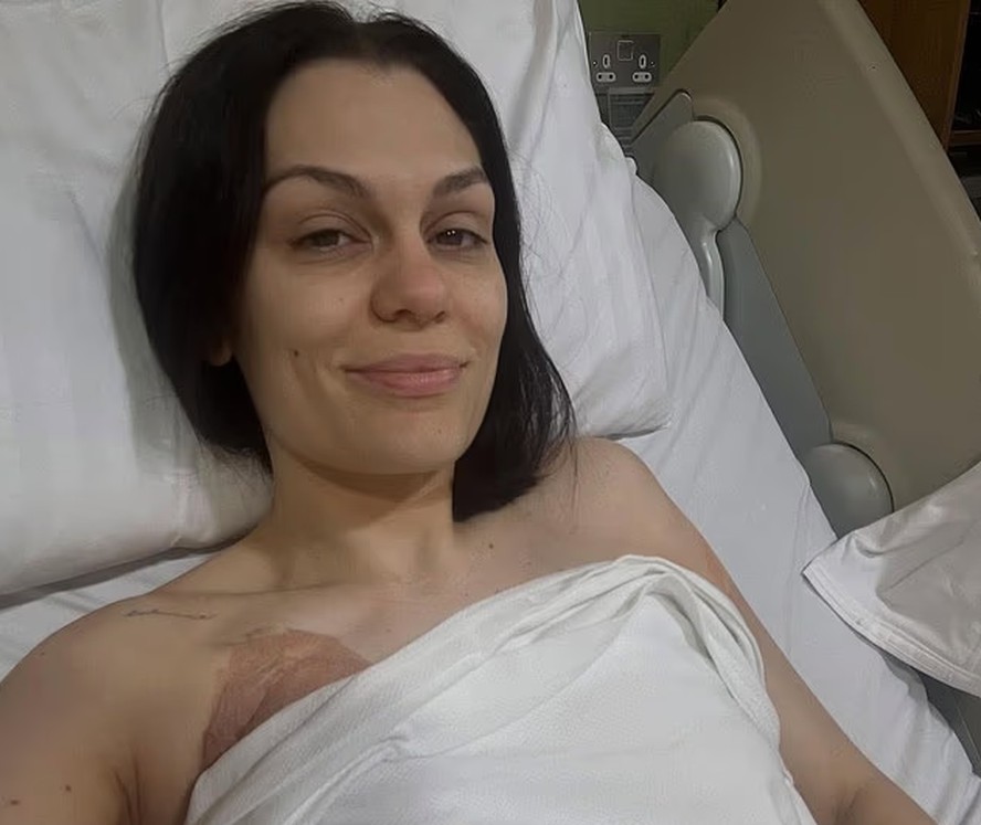 Jessie J passou por cirurgia após descobrir câncer de mama