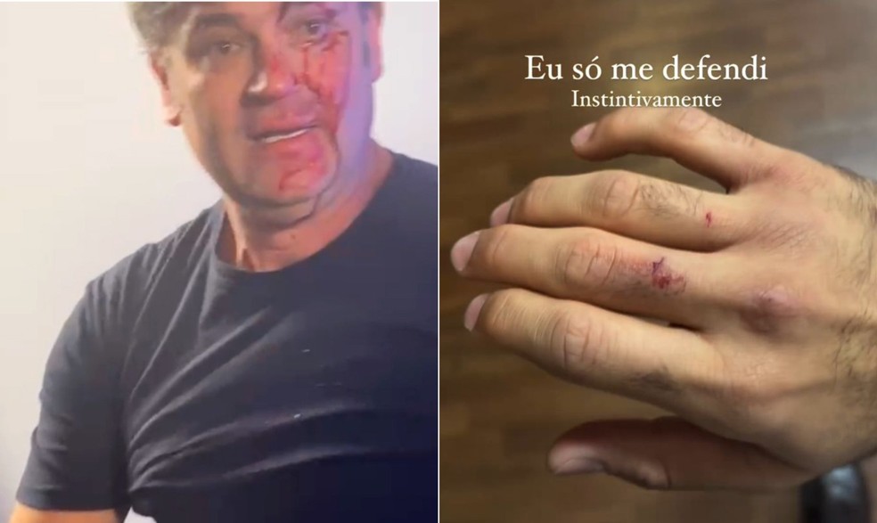 Marqueteiro Duda Lima (à esquerda) com o rosto ensanguentado após soco de Nahuel Medina, assessor de Marçal, que se manifestou à direita — Foto: Reprodução