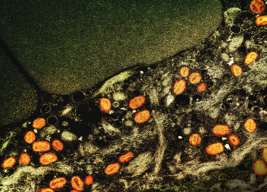 Micrografia eletrônica de transmissão colorida de partículas do vírus da varíola dos macacos (laranja) encontradas dentro de uma célula infectada (marrom), cultivadas em laboratório. NIAID