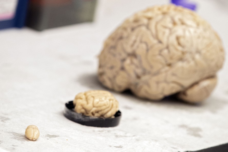 Estudo identifica região do cérebro que pode ser a primeira afetada pelo Alzheimer