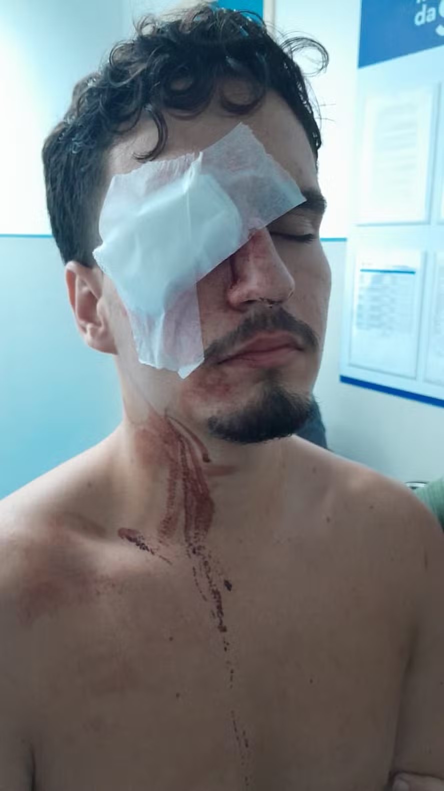 Atingido por bala de borracha após clássico, torcedor do Vasco diz acreditar em 'milagre' para recuperar visão