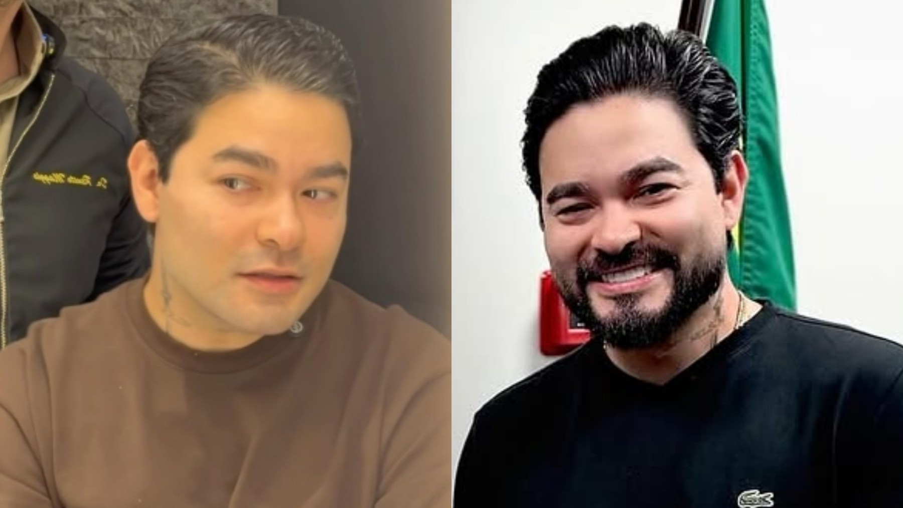 Harmonização facial masculina: o que o caso de Yudi Tamashiro revela sobre a busca por um rosto mais definido - Foto