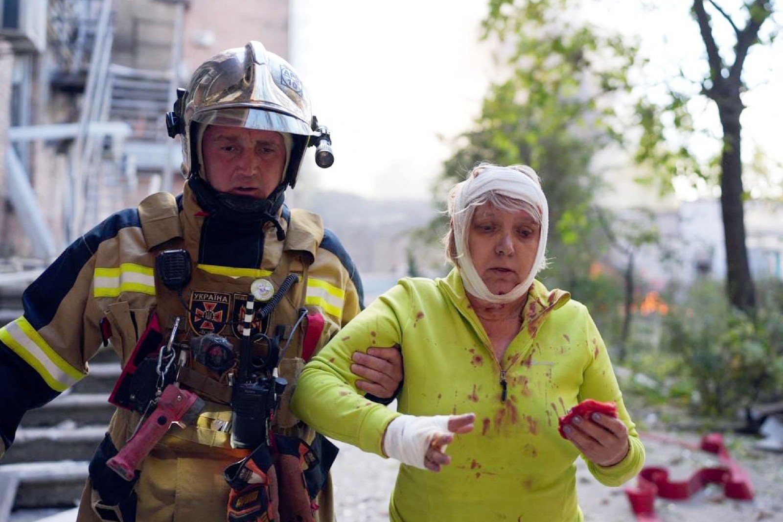 Uma moradora é socorrida após os ataques em Kiev. Prédios residenciais foram alvo de mísseis russos — Foto: HANDOUT / State Emergency Service of Ukraine / AFP