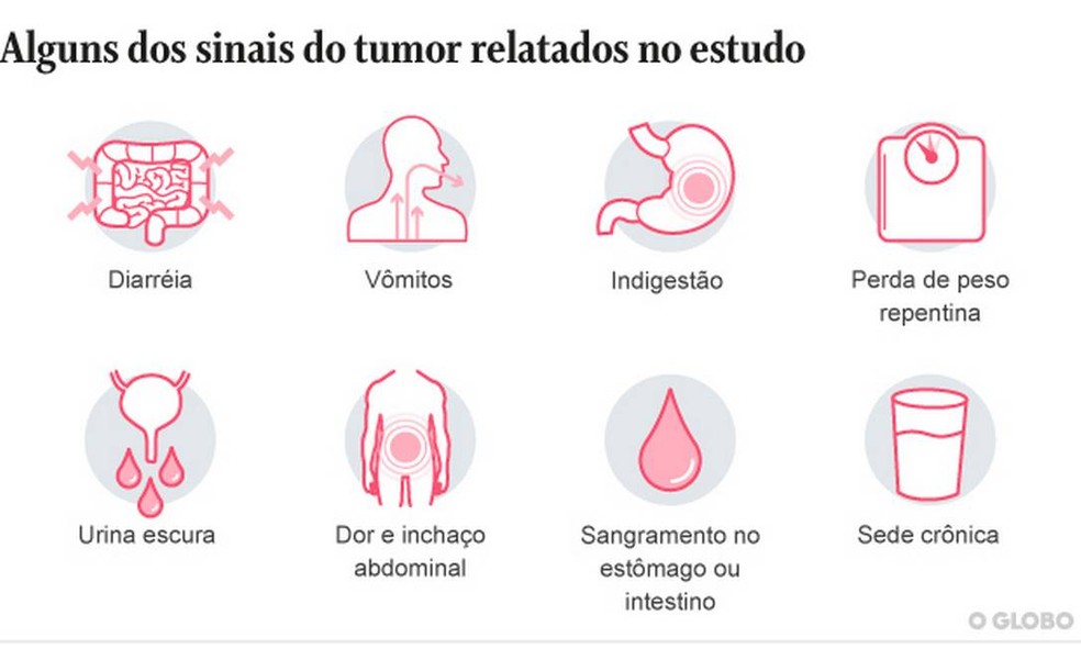 Alguns dos 23 sintomas do câncer de pâncreas identificados por cientistas de Oxford. — Foto: Arte O Globo