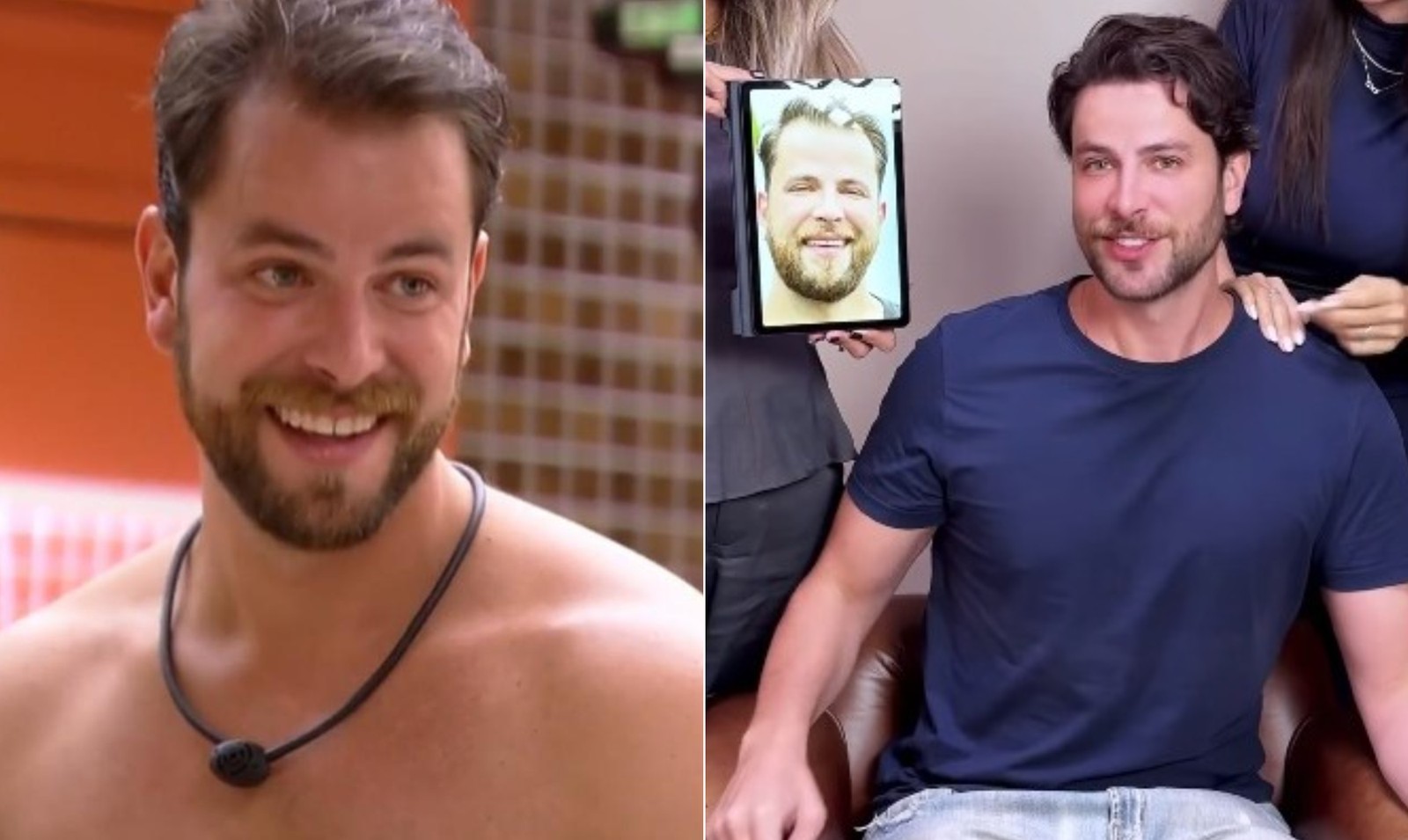 'BBB 22' Gustavo Marsengo lost 23 kg, underwent hair transplant and facial toning — Photo: Reproduction