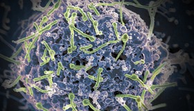 Ebola se esconde no sistema nervoso central, descobre estudo