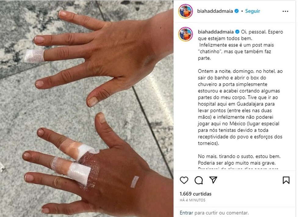 Bia Haddad compartilha mãos feridas após acidente em box do banheiro — Foto: Reprodução/Redes sociais