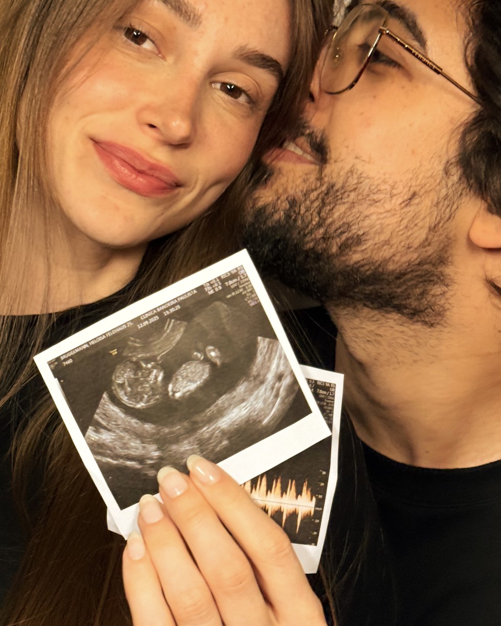 Após um ano de casados, Zeeba e Heloísa Brüggemann anunciam gravidez — Foto: Divulgação