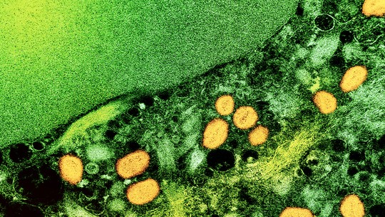 Fiocruz: registro de estudos sobre varíola dos macacos terá prioridade no Brasil