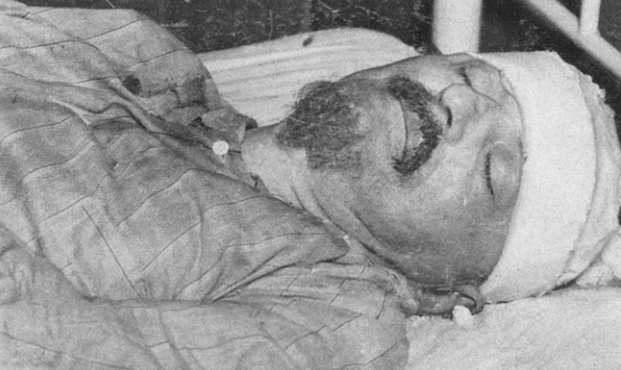 León Trotsky após o golpe de picareta na cabeça, em 1940