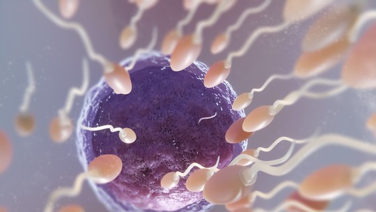 Infertilidade: quantidade de espermatozoides não diminui, mas sua mobilidade sim, mostra estudo