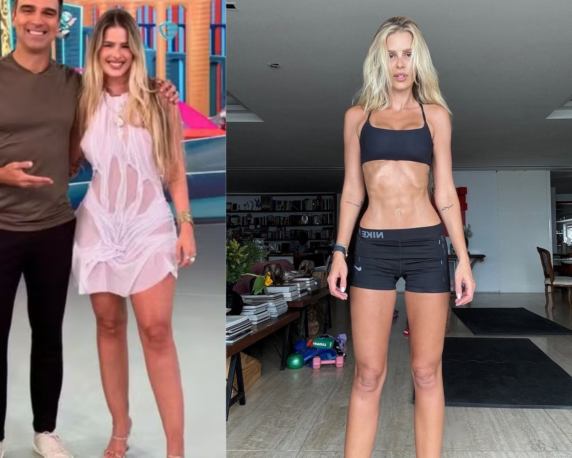 Lipedema: além de Bárbara Reis, famosas como Paolla Oliveira e Yasmin Brunet ampliam debate sobre diagnóstico