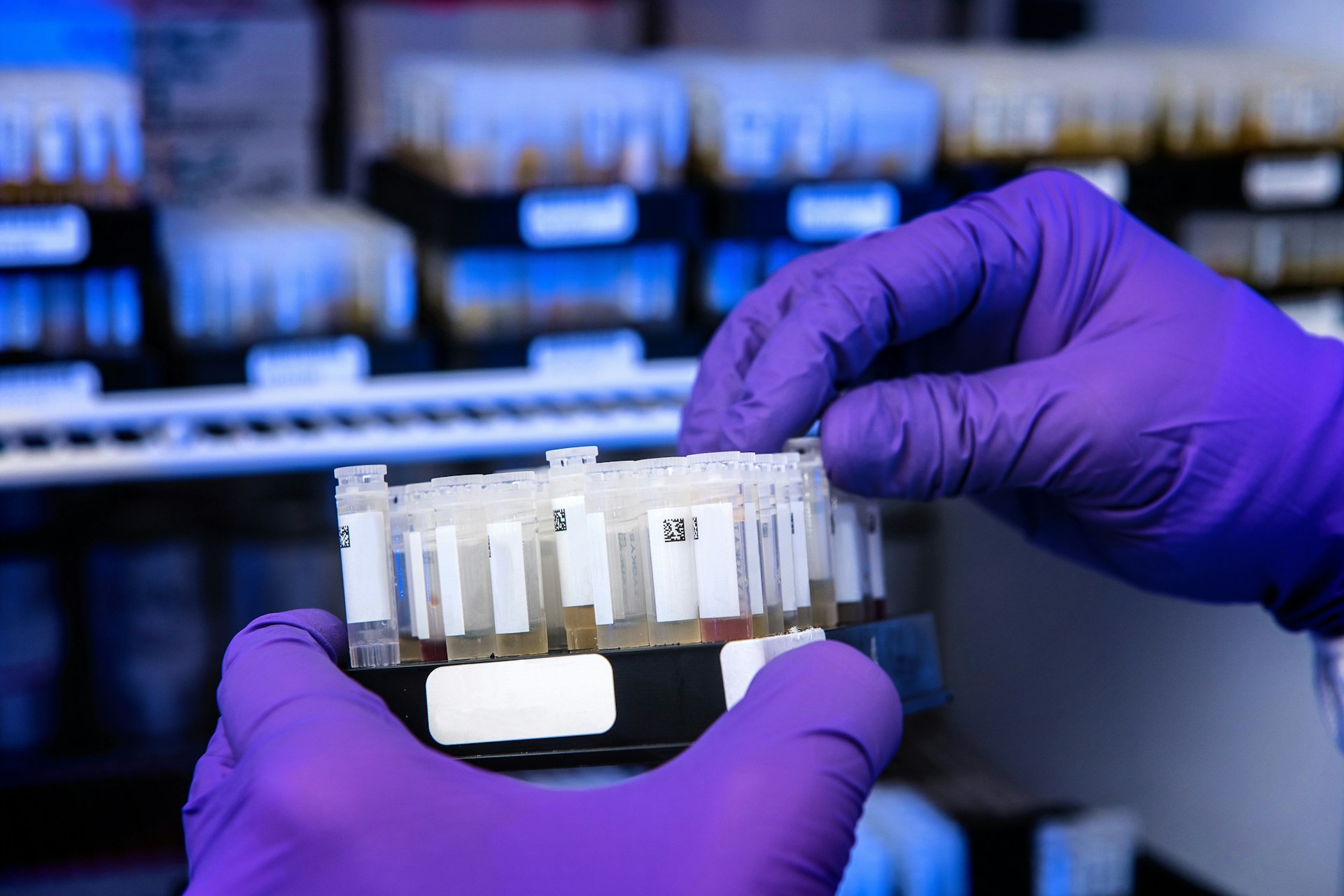 Câncer de colo de útero: teste molecular de HPV, que vai substituir Papanicolau no SUS, identifica quase 4 vezes mais casos da infecção