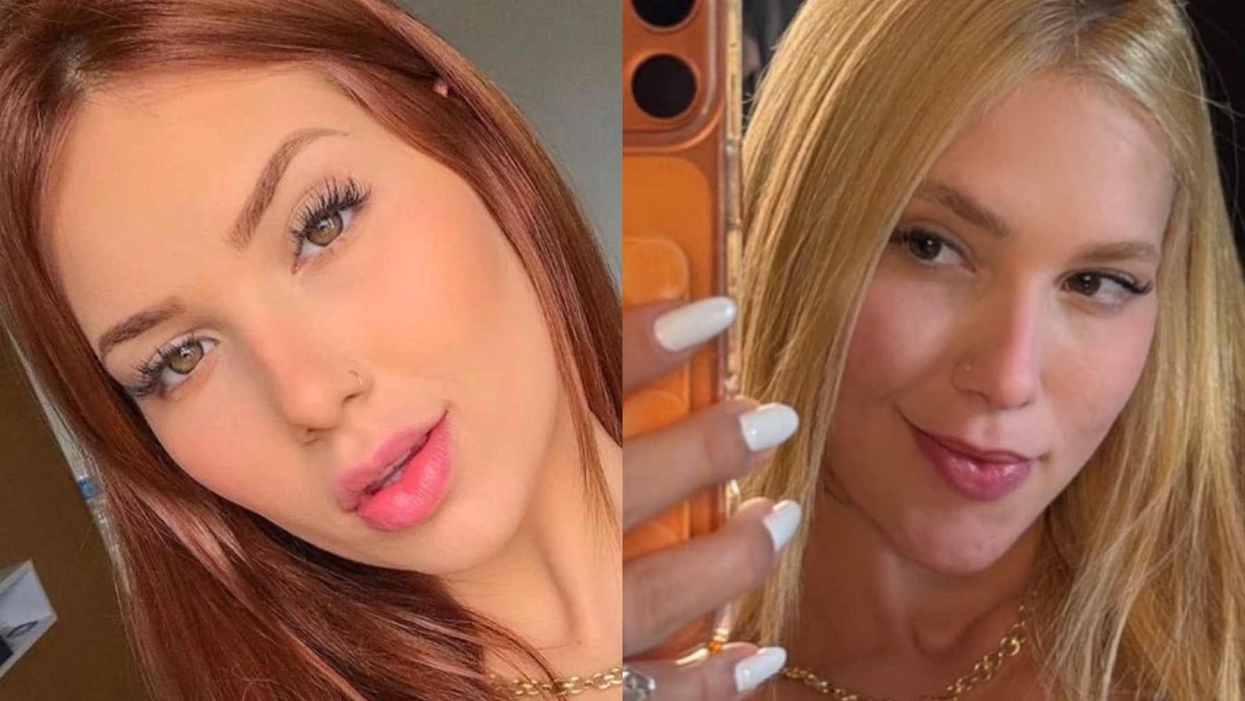 Antes e depois de Virginia Fonseca viraliza; procedimentos em excesso podem mudar o rosto? - QTU Questões do Universo
