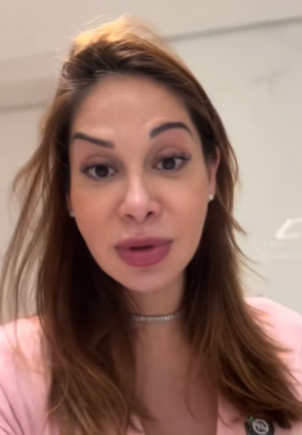 Myra Cardi case: Understanding the causes of asymmetry after Botox application - Image: Instagram Reproduction