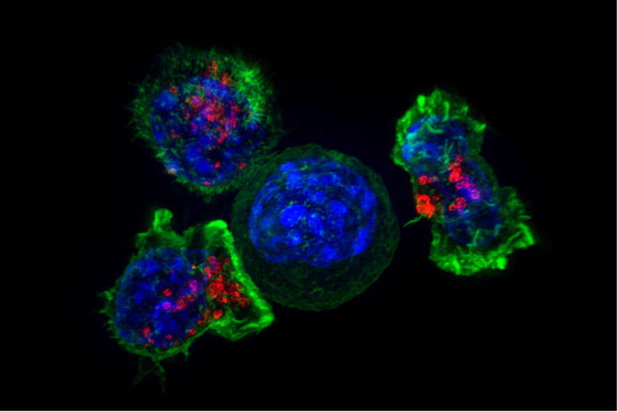 Células exterminadoras do sistema imune atacam célula tumoral