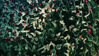 Vírus mpox (em vermelho), antes chamado de monkeypox ou varíola dos macacos — Foto: Wikimedia Commons