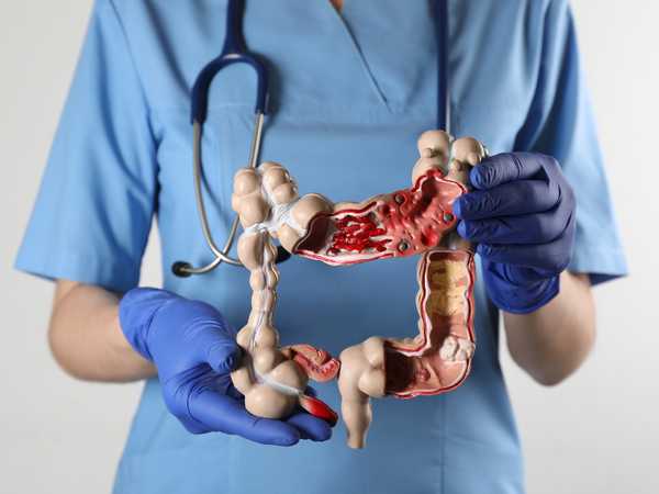 Especialista de Harvard revela qual &eacute; o 'alimento ideal' na preven&ccedil;&atilde;o do  c&acirc;ncer de intestino