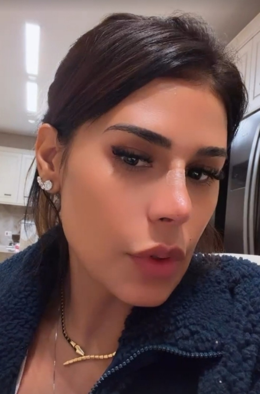 Simone Mendes nega rinoplastia e conta qual t&eacute;cnica usou no nariz &mdash; Foto: Reprodu&ccedil;&atilde;o Instagram