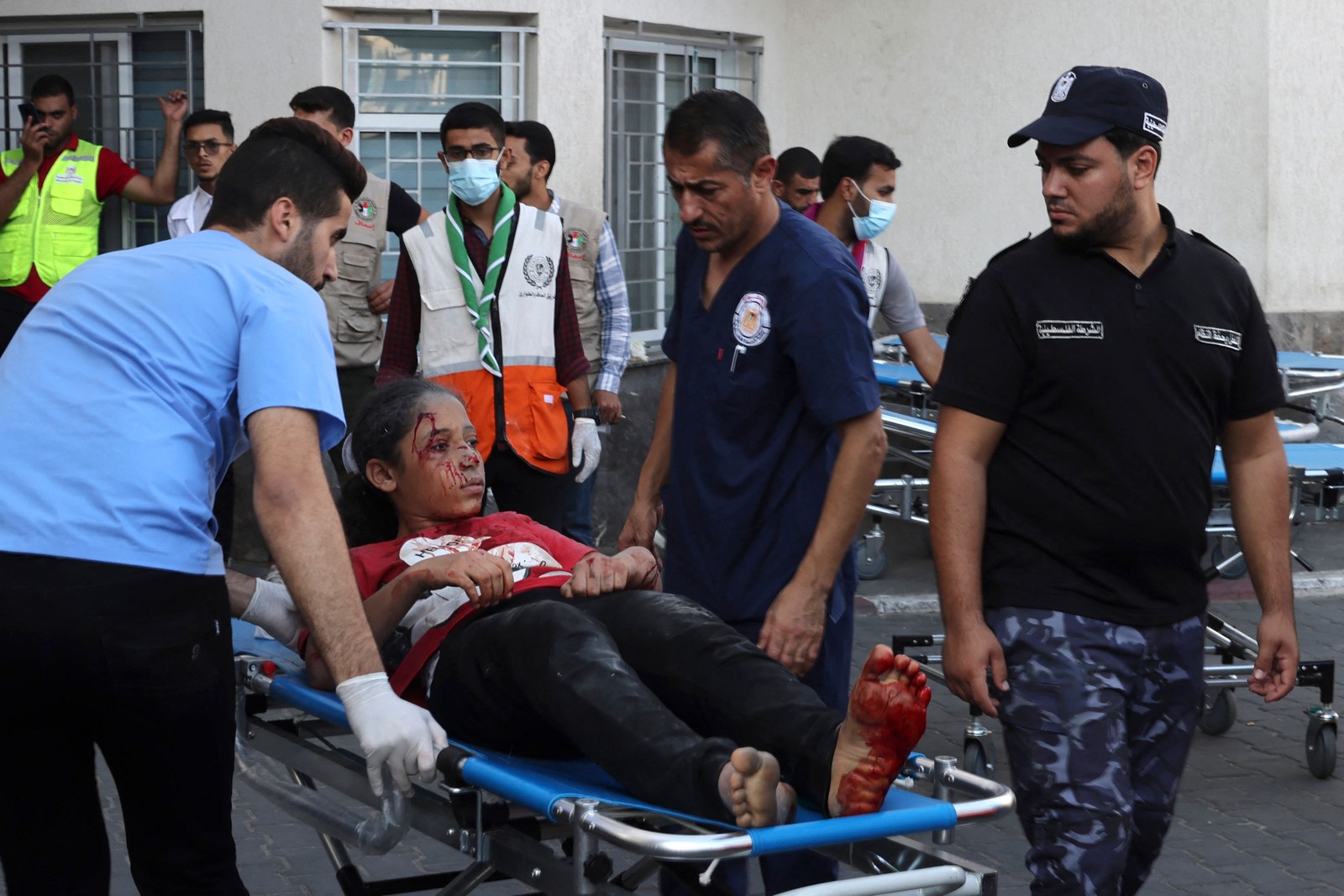 Enquanto as imagens eram feitas, mais feridos chegavam ao local, já sobrecarregado — Foto: Mohammed Abed /AFP