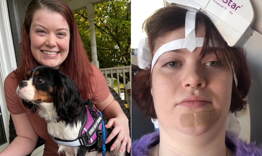 Alyssa Davis, de 26 anos, sofre de hipersonia idiopática