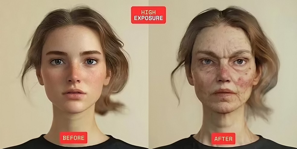 Mulher submetida a níveis altos de contaminação por microplásticos — Foto: Reprodução