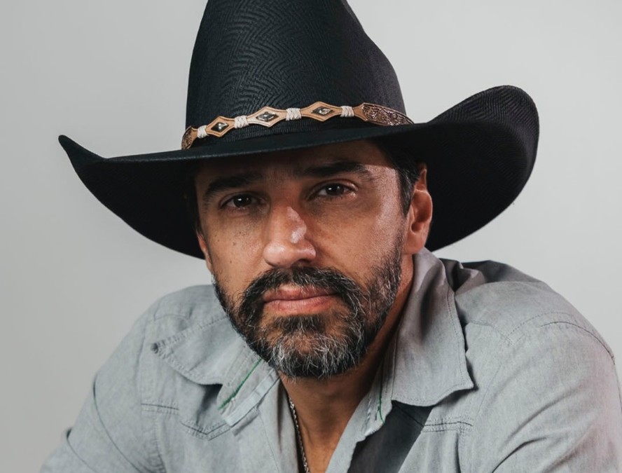 Imagem ilustrativa sobre Alberto Cowboy colhe frutos do BBB 26, realiza maior sonho e escancara procedimentos estéticos: 'Aqui fora é vida real'