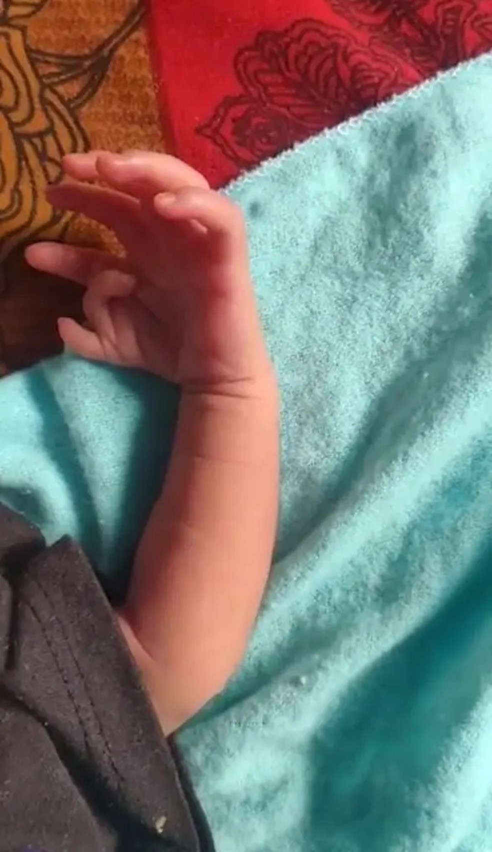 Mão da bebê que nasceu com 26 dedos ao todo — Foto: Reprodução