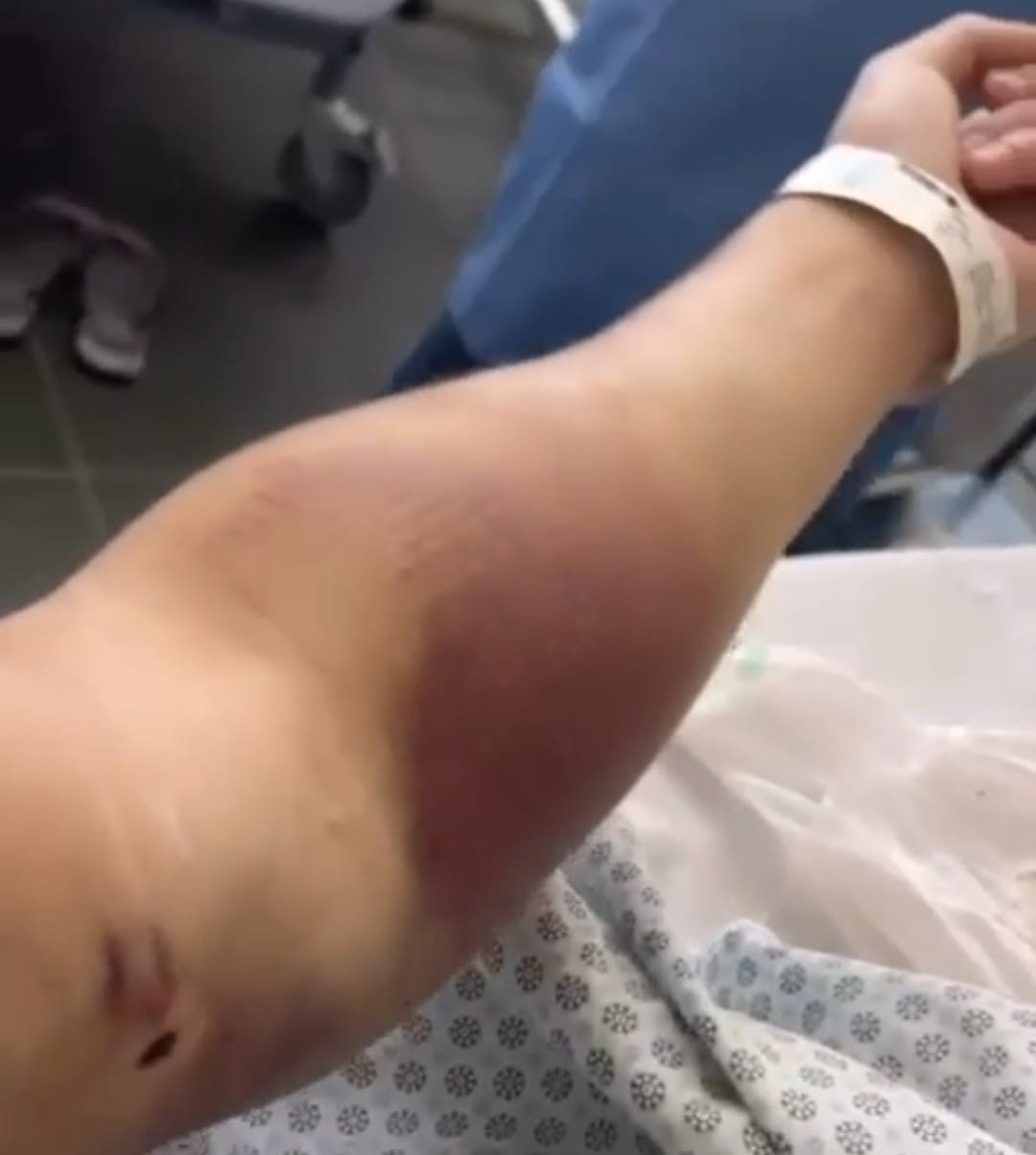 Turista canadense torturado no Rio segue internado no Souza Aguiar; homem belga é suspeito