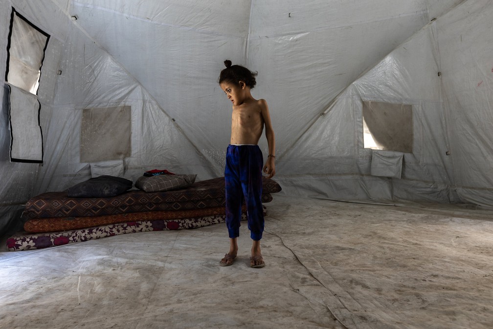 Criança desnutrida em Gaza — Foto: Saher Alghorra / The New York Times