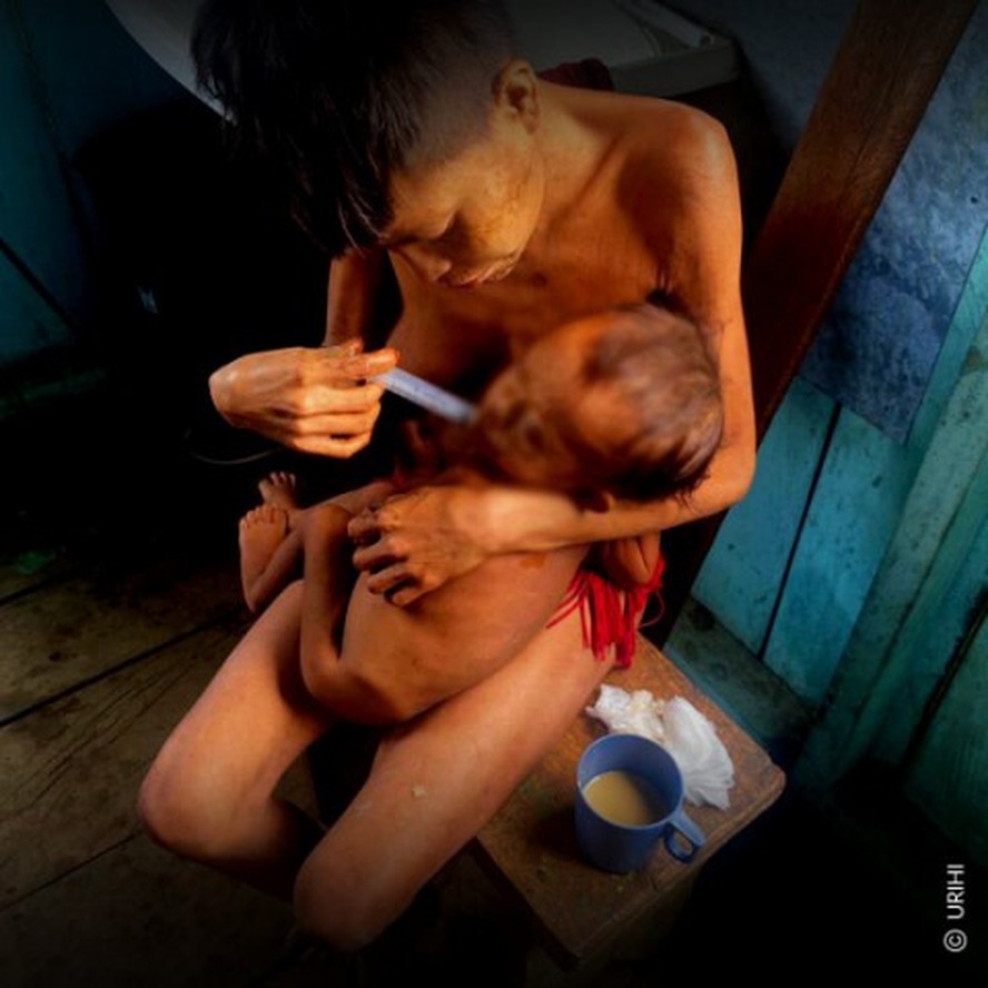 Mãe alimenta criança ianomâmi desnutrida