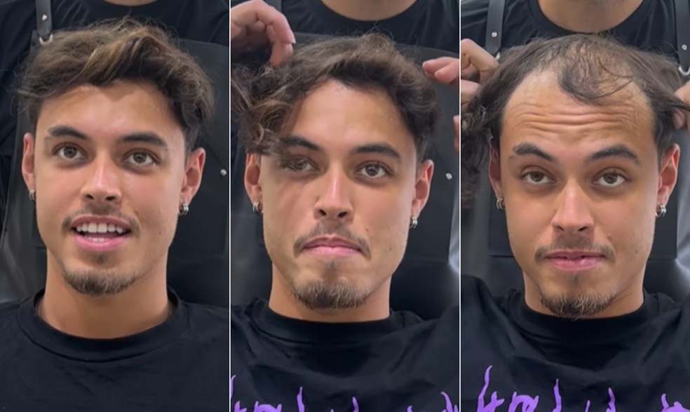O influenciador digital Luiz Mar&atilde;es, de 25 anos, mostra como faz para esconder careca: fios presos com grampos &mdash; Foto: Reprodu&ccedil;&atilde;o/Instagram