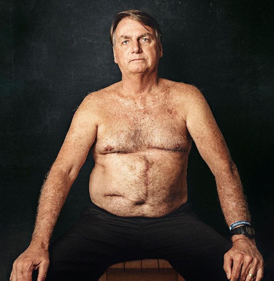 Foto de Bolsonaro sem camisa foi publicada nas redes do assessor Fabio Wajngarten