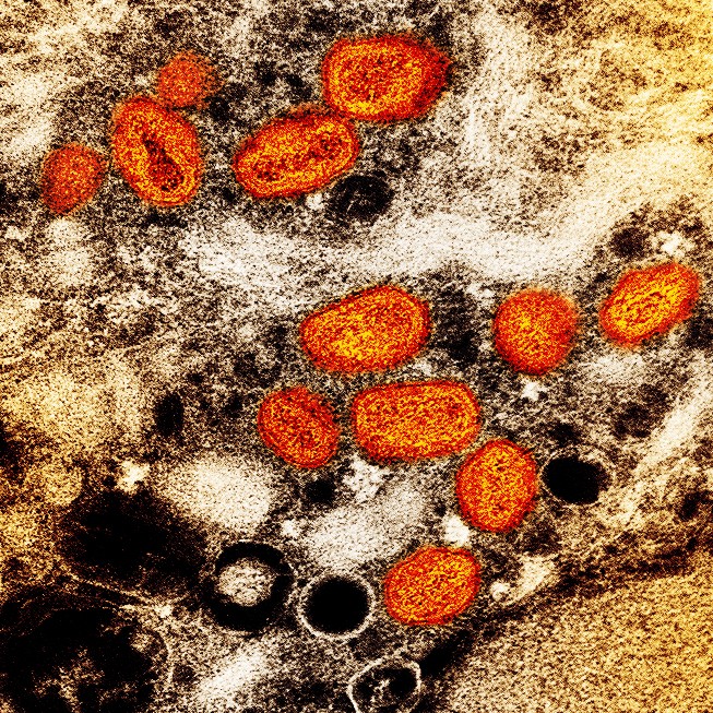 Micrografia eletrônica de transmissão colorida de partículas do vírus da varíola dos macacos (laranja) encontradas dentro de uma célula infectada (marrom), cultivadas em laboratório. — Foto: NIAID
